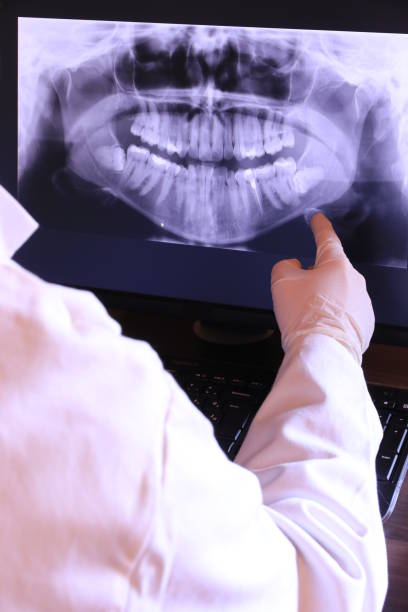 Best Emergency Root Canal Treatment in Shawneeland, VA