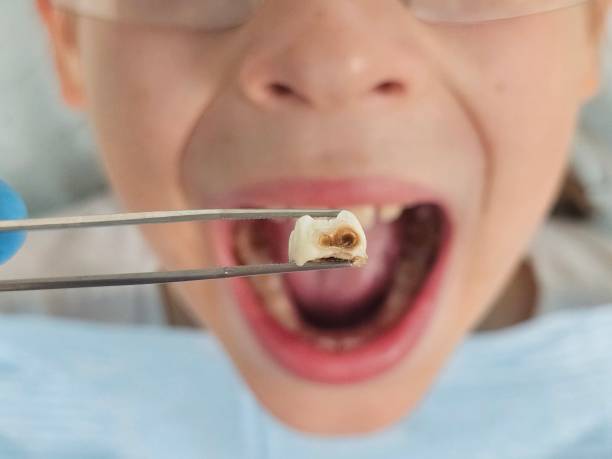 Best Emergency Dental Services for Seniors in Shawneeland, VA